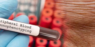 new-diagnostic-tool-identifies-and-treats-rare-skin-condition