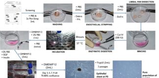 lvpei-secures-australian-patent-for-novel-corneal-stem-cell