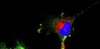 unlocking-new-targets-the-role-of-prion-proteins-in-glioblastoma-treatment