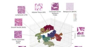 ai-tool-detects-colorectal-cancer-with-96-74-accuracy