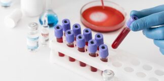 electric-field-molecular-fingerprinting-in-blood-plasma-could-transform-cancer-diagnosis