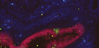 newly-discovered-pnscs-hope-for-neurodegenerative-disease