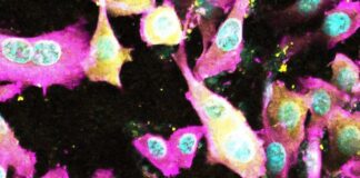 scientists-uncover-how-e-coli-uses-molecular-scissors