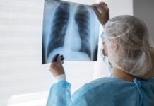 bpalm-regimen-offers-hope-for-drug-resistant-tb-patients