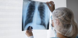 bpalm-regimen-offers-hope-for-drug-resistant-tb-patients