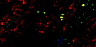 immunotherapy-reverses-cholesterol-induced-heart-cell-damage