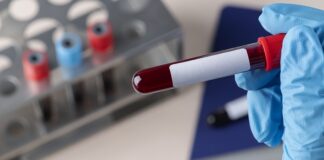 iiit-a-develops-device-for-blood-plasma-separation-purification