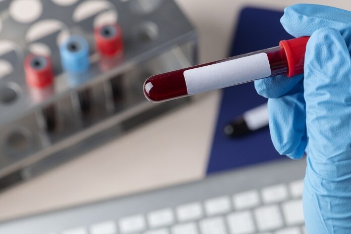 iiit-a-develops-device-for-blood-plasma-separation-purification