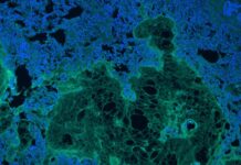 injectable-hydrogel-offers-breakthrough-in-sealing-tissue-injuries