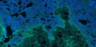 injectable-hydrogel-offers-breakthrough-in-sealing-tissue-injuries