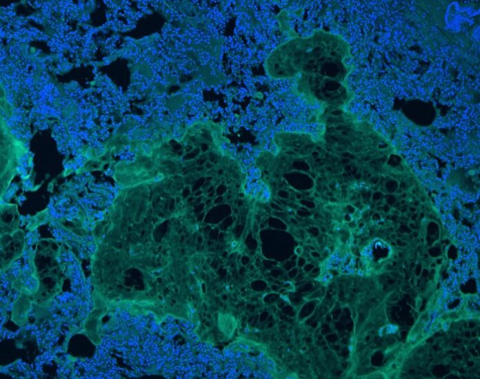 Injectable Hydrogel Offers Breakthrough in Sealing Tissue Injuries injectable-hydrogel-offers-breakthrough-in-sealing-tissue-injuries