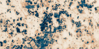 new-3d-virtual-staining-technology-revolutionizes-non-invasive-cancer-tissue-diagnosis