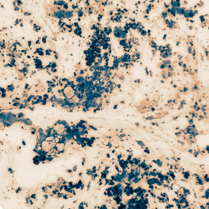 new-3d-virtual-staining-technology-revolutionizes-non-invasive-cancer-tissue-diagnosis