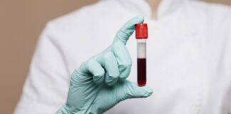 cost-effective-blood-test-for-early-alzheimers-detection