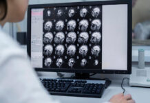 doctors-urge-early-detection-as-brain-tumour-cases-climb
