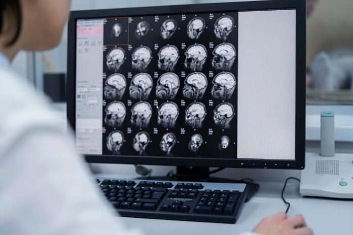 Doctors Urge Early Detection as Brain Tumour Cases Climb doctors-urge-early-detection-as-brain-tumour-cases-climb