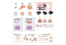 hkusts-mome-ai-transforms-breast-cancer-diagnosis-with-mri