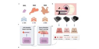 hkusts-mome-ai-transforms-breast-cancer-diagnosis-with-mri