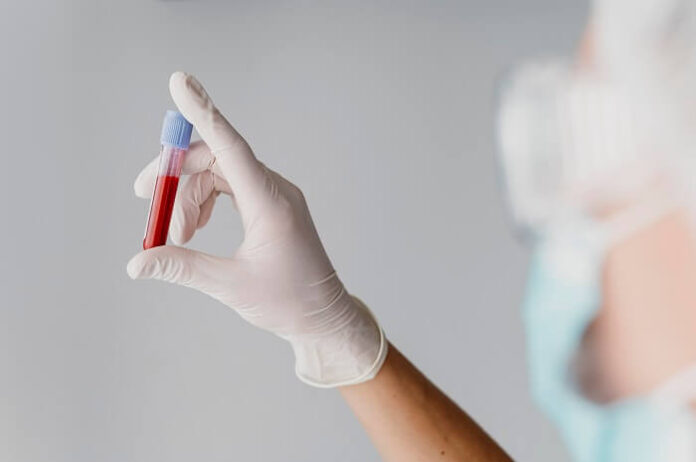 blood-test-detects-early-signs-of-liver-transplant-complications