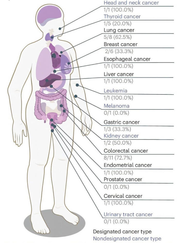 Blood Test Shows Accuracy in Detecting Multiple Cancers Early blood-test-shows-accuracy-in-detecting-multiple-cancers-early
