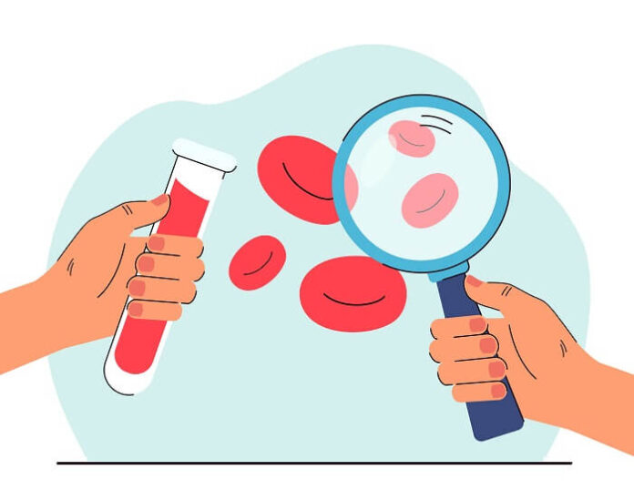Japan’s Breakthrough in Artificial Blood May End Shortages japans-breakthrough-in-artificial-blood-may-end-shortages
