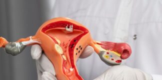 over-10-crore-women-screened-for-cervical-cancer