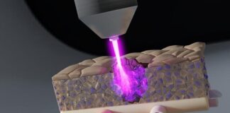 cold-plasma-shows-promise-against-tumor-cells-in-deeper-tissues