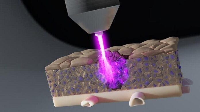 Cold Plasma Shows Promise Against Tumor Cells in Deeper Tissues cold-plasma-shows-promise-against-tumor-cells-in-deeper-tissues