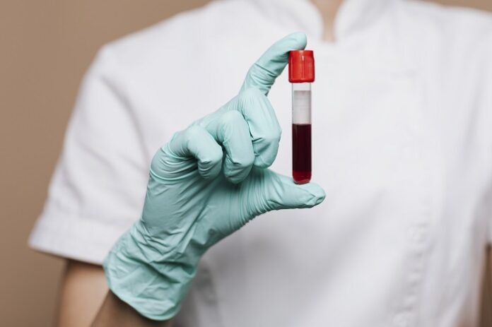 india-identifies-new-crib-blood-antigen-globally