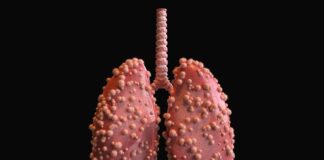 three-month-old-diagnosed-with-drug-resistant-tb