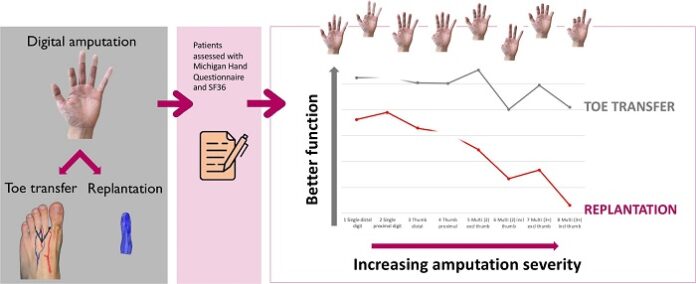 toe-transfer-surgery-shows-hand-function-over-replantation