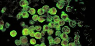 kerala-reports-fifth-death-from-amoebic-meningoencephalitis