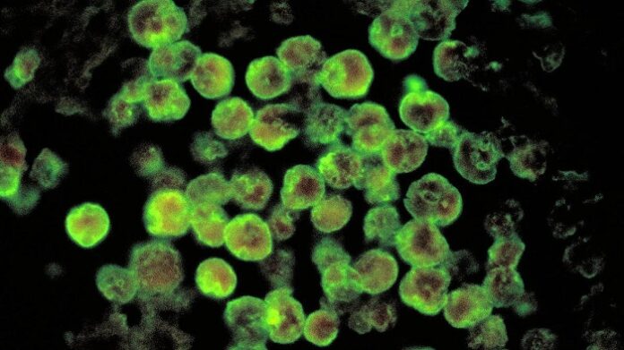Kerala Reports Fifth Death from Amoebic Meningoencephalitis kerala-reports-fifth-death-from-amoebic-meningoencephalitis