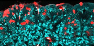 maternal-food-additives-disrupt-offspring-gut-microbiota