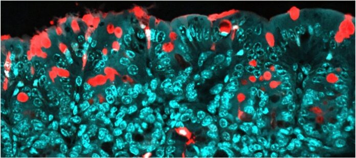 Maternal Consumption of Food Additives Disrupts Offspring Gut Microbiota maternal-food-additives-disrupt-offspring-gut-microbiota