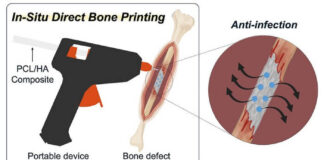 scientists-create-glue-gun-inspired-tool-for-bone-repair