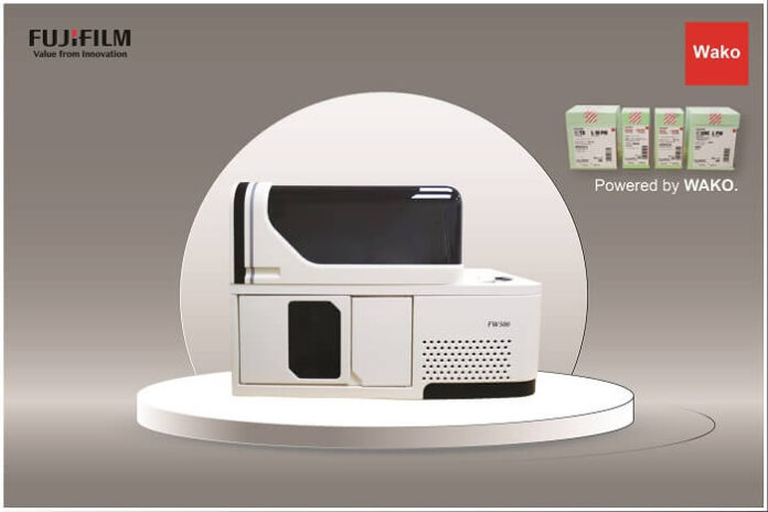 FUJIFILM India Expands Portfolio with Launch of FW500 fujifilm-india-expands-portfolio-with-launch-of-fw500