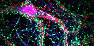 johns-hopkins-team-finds-hidden-brain-network-that-could-unlock-alzheimers-clues