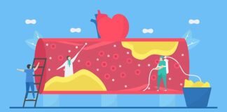 lower-cholesterol-linked-to-reduced-dementia-risk