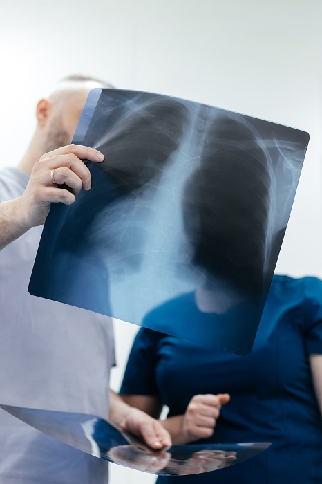 Steroids Could Boost the Body’s Defense Against Tuberculosis steroids-could-boost-the-bodys-defense-against-tuberculosis