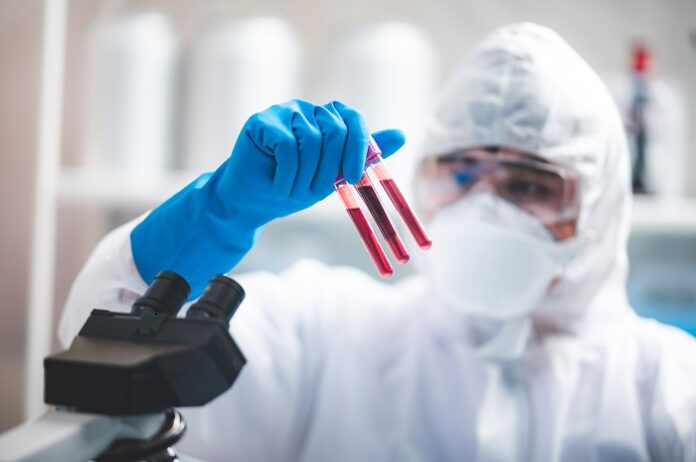 Scientists Develop Accurate Blood Test for CFS scientists-develop-accurate-blood-test-for-cfs
