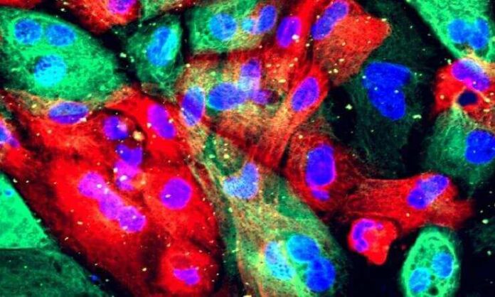 Targeting PDIA1 and PDIA5 May Revolutionize Cancer Treatment targeting-pdia1-and-pdia5-may-revolutionize-cancer-treatment
