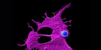 engineered-nkt-cells-power-multi-pathway-pancreatic-therapy