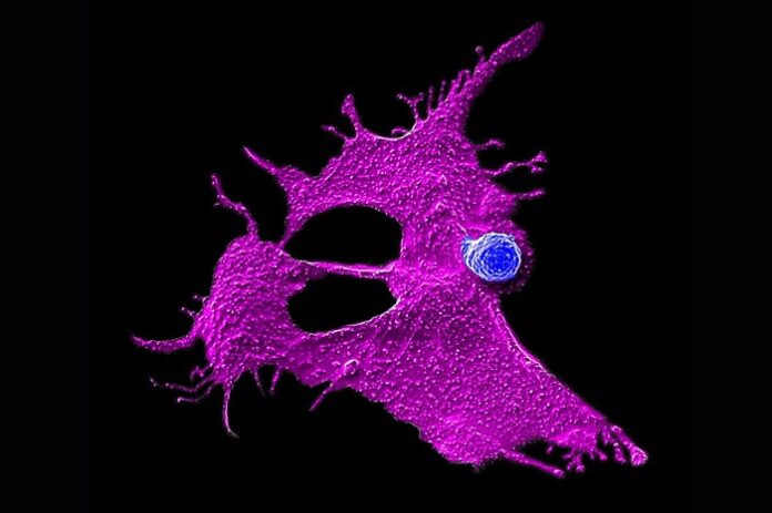 Engineered NKT Cells Power Multi-Pathway Pancreatic Therapy engineered-nkt-cells-power-multi-pathway-pancreatic-therapy