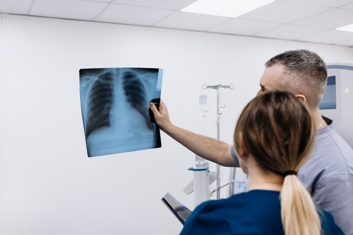 India Records Decline in TB : WHO Global TB Report 2025 india-records-sharp-decline-in-tb-incidence-who-global-tb-report-2025