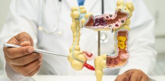marine-bacterium-shows-potential-against-colorectal-cancer