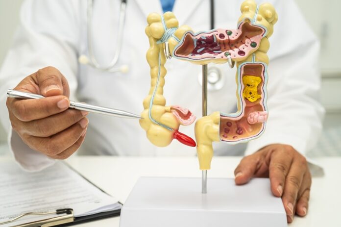 marine-bacterium-shows-potential-against-colorectal-cancer