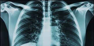 nadda-calls-for-mission-mode-healthcare-reforms-and-tb-free-india-by-2027