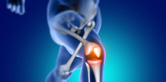 rethinking-knee-replacement-why-one-size-fits-all-no-longer-works
