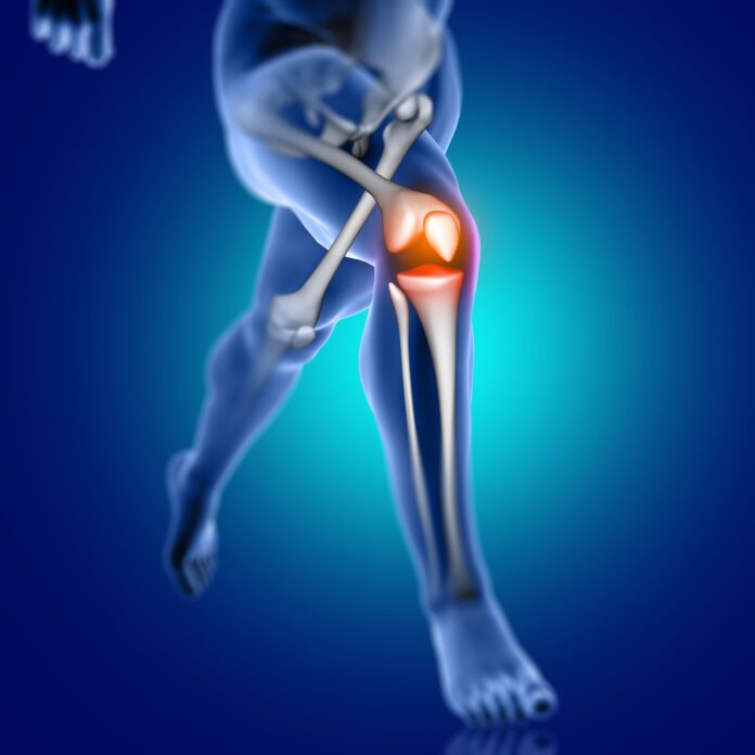 Rethinking Knee Replacement: Why One‑Size‑Fits‑All No Longer Works rethinking-knee-replacement-why-one-size-fits-all-no-longer-works